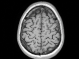 Still frame Tumult (2025)