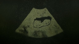 Kader iz filma Nihče ni nikoli gledal slonov kot ti (2025)